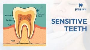 Sensitive Teeth - Why That Ice Cream Hurts and what you can do about it - Pasqua South Dental
