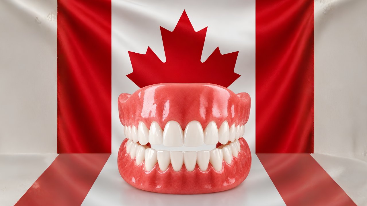 Are Dentures Covered by the Canadian Dental Care Plan