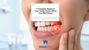 tooth hurts when biting down